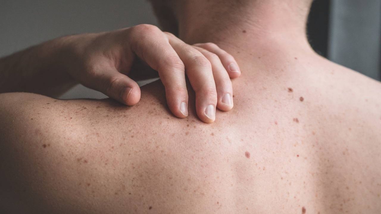 Earlier Detection of Skin Cancer and Precancerous Changes